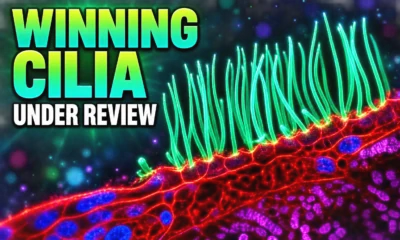 Nikon Small World in Motion AI cilia video review